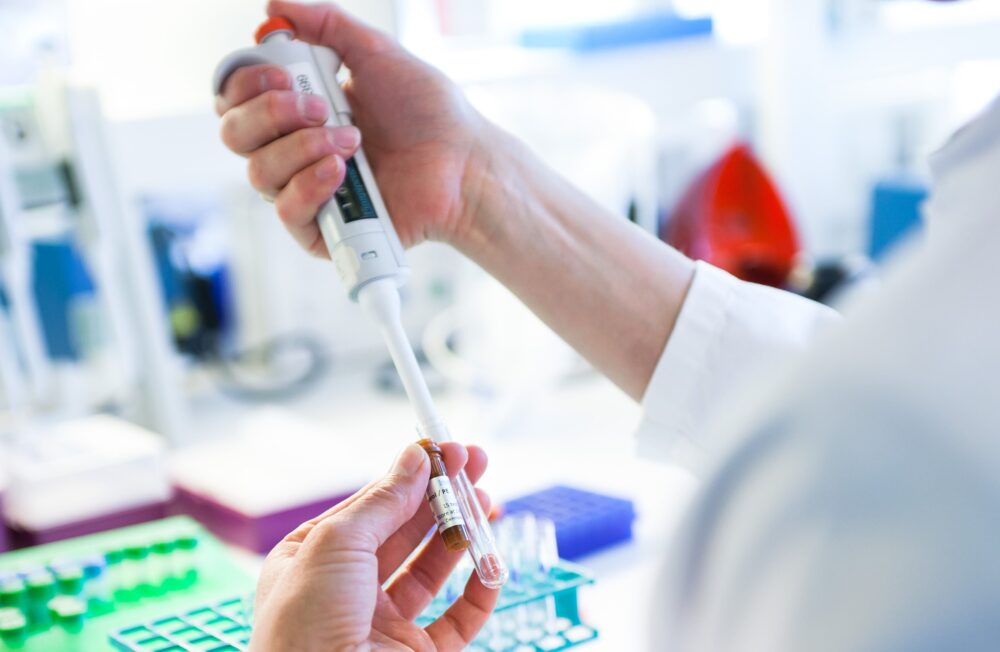 Laborant hos Immudex anvender finpipette til overførsel af prøvemateriale i reagensglas under kvalitetssikret bioteknologisk produktion.